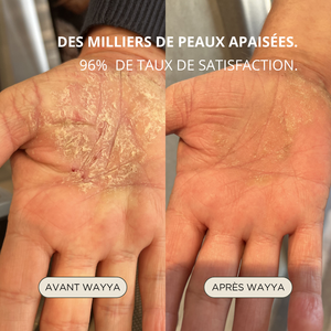 Rituel Peau Sensible｜Peaux sensibles, sèches & réactives