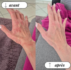 Rituel Peau sensible｜Apaisant & réparateur